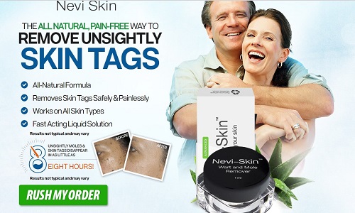 Nevi Skin Mole Wart Removal Cream Reviews